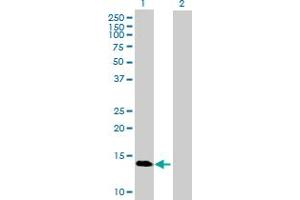 Western Blot analysis of GBA3 expression in transfected 293T cell line by GBA3 MaxPab polyclonal antibody. (GBA3 antibody  (AA 1-162))