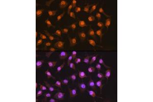 Immunofluorescence analysis of HeLa cells using PER2 Rabbit mAb (ABIN7269224) at dilution of 1:100 (40x lens). (PER2 antibody)