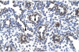 Immunohistochemical staining (Formalin-fixed paraffin-embedded sections) of human lung with FOXA3 polyclonal antibody  at 4-8 ug/mL working concentration. (FOXA3 antibody  (Internal Region))
