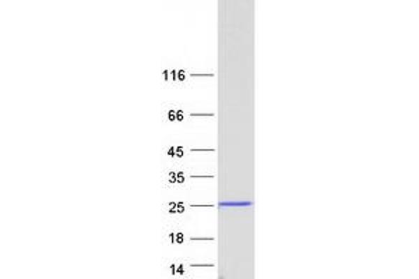 NDUFAF2 Protein (Myc-DYKDDDDK Tag)