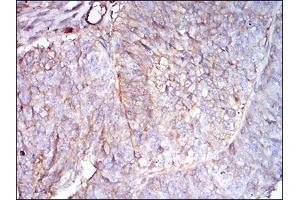 Immunohistochemistry (IHC) image for anti-beta-2-Microglobulin (B2M) (AA 21-100) antibody (ABIN1724930)
