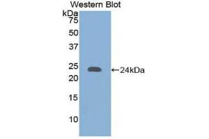 Western Blotting (WB) image for anti-Collagen, Type XVIII (COL18) (AA 1572-1754) antibody (ABIN1858449) (COL18 antibody  (AA 1572-1754))