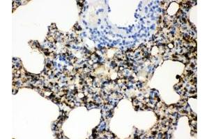 IHC testing of FFPE rat lung with SFTPA1/2 antibody. (SFTPA1/ 2 antibody)
