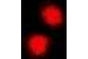 Immunofluorescent analysis of PRDM5 staining in A549 cells. (PRDM5 antibody)