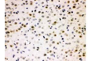 Anti- Cdc25B Picoband antibody, IHC(P) IHC(P): Rat Brain Tissue
