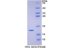 SDS-PAGE of Protein Standard from the Kit (Highly purified E. (FABP3 ELISA Kit)