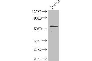 Western Blot Positive WB detected in: Jurkat whole cell lysate All lanes: SPPL2A antibody at 2 μg/mL Secondary Goat polyclonal to rabbit IgG at 1/50000 dilution Predicted band size: 59 kDa Observed band size: 59 kDa