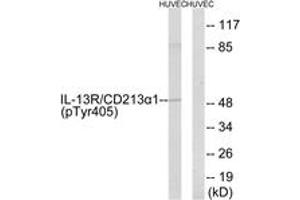 Western blot analysis of extracts from HuvEc cells treated with serum 20% 15', using IL-13R alpha1 (Phospho-Tyr405) Antibody. (IL13 Receptor alpha 1 antibody  (pTyr405))