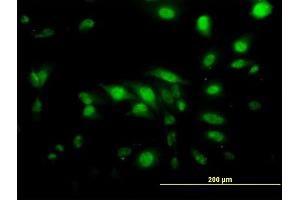 Immunofluorescence of monoclonal antibody to CAPG on HeLa cell. (CAPG antibody  (AA 1-348))
