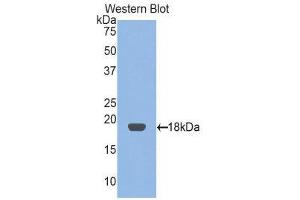 Western Blotting (WB) image for anti-Retinol Binding Protein 2, Cellular (RBP2) (AA 1-134) antibody (ABIN1078478) (RBP2 antibody  (AA 1-134))
