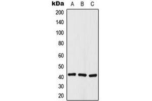 Western blot analysis of Histone Deacetylase 8 (pS39) expression in A549 (A), NIH3T3 (B), rat kidney (C) whole cell lysates. (HDAC8 antibody  (N-Term, pSer39))