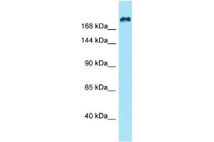 WB Suggested Anti-KIF21B Antibody Titration: 1. (KIF21B antibody  (N-Term))