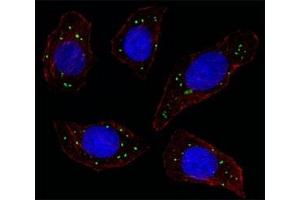 Fluorescent image of U251 cell stained with MERTK antibody at 1:25.
