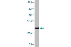 Western Blot detection against Immunogen (36. (MTA1 antibody  (AA 601-700))