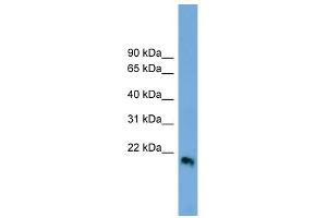 IFN Beta 1 antibody used at 1 ug/ml to detect target protein. (IFN beta 1 (Middle Region) antibody)
