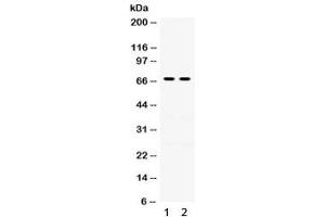 Western blot testing of human 1) A431 and 2) A549 lysate with Involucrin antibody. (Involucrin antibody)
