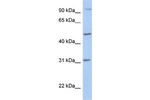 WB Suggested Anti-PPM1J Antibody Titration: 0.