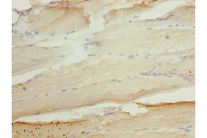 Immunohistochemistry of paraffin-embedded human skeletal muscle tissue using ABIN7144572 at dilution of 1:100 (ASAP3 antibody  (AA 451-700))