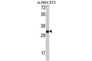 Image no. 1 for anti-Four and A Half LIM Domains 1 (FHL1) (C-Term) antibody (ABIN453000) (FHL1 antibody  (C-Term))