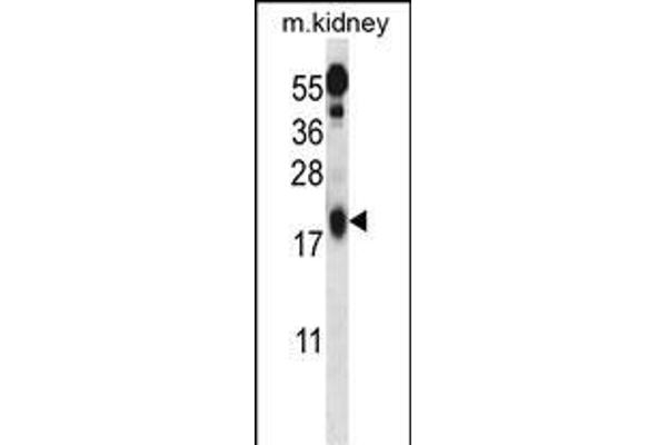 UFC1 antibody  (C-Term)