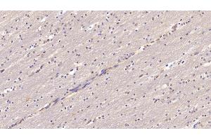 Detection of CHEM in Human Cerebrum Tissue using Monoclonal Antibody to Chemerin (CHEM) (CHEM (AA 33-158) antibody)