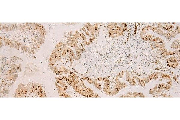 RFX6 antibody