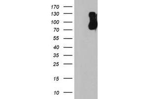 HEK293T cells were transfected with the pCMV6-ENTRY control (Left lane) or pCMV6-ENTRY FBXO21 (Right lane) cDNA for 48 hrs and lysed. (FBXO21 antibody)