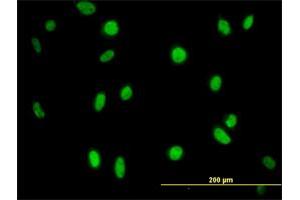 Immunofluorescence of monoclonal antibody to MPG on HeLa cell. (MPG antibody  (AA 1-90))