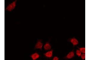 ABIN6269258 staining 293 by IF/ICC. (GATA4 antibody  (Internal Region))