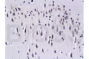 Formalin-fixed and paraffin embedded rat brain labeled with Mouse Anti-Calcineurin A/PP-2B alpha 1 Polyclonal Antibody (ABIN723890), Unconjugated 1:200 followed by conjugation to the secondary antibody and DAB staining (Calcineurin A antibody  (AA 15-80))