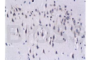 Calcineurin A anticorps  (AA 15-80)