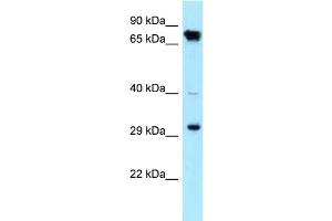 WB Suggested Anti-CDK4 Antibody Titration: 1. (CDK4 antibody  (C-Term))