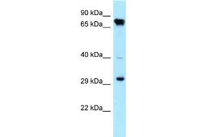 WB Suggested Anti-CDK4 Antibody Titration: 1.