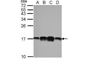 WB Image Sample (30 ug of whole cell lysate) A: 293T B: A431 C: HeLa D: HepG2 15% SDS PAGE antibody diluted at 1:1000 (PFN1 antibody)