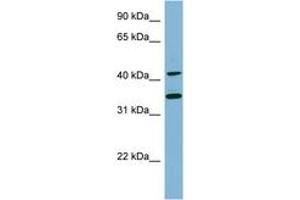 Image no. 1 for anti-B-Cell Linker (BLNK) (C-Term) antibody (ABIN6741821) (B-Cell Linker antibody  (C-Term))
