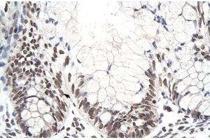 Rabbit Anti-ZNF394 Antibody Catalog Number: ARP30072 Paraffin Embedded Tissue: Human Intestine Cellular Data: Epithelial cells of intestinal villas Antibody Concentration: 4. (ZNF394 antibody  (N-Term))