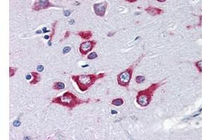 Image no. 3 for anti-Kinesin Family Member 5A (KIF5A) (Center) antibody (ABIN372915) (KIF5A antibody  (Center))