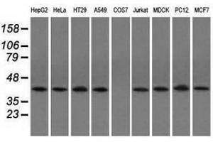 Image no. 2 for anti-Acetyl-CoA Acetyltransferase 2 (ACAT2) antibody (ABIN1496401) (ACAT2 antibody)