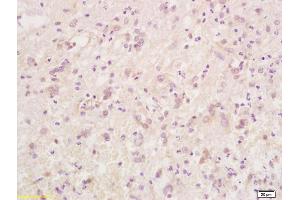 Formalin-fixed and paraffin embedded rat brain tissue labeled with Anti-Phospho-Caspase-9 (Thr125) Polyclonal Antibody, Unconjugated (ABIN683863) at 1:200 followed by conjugation to the secondary antibody and DAB staining (Caspase 9 antibody  (pThr125))