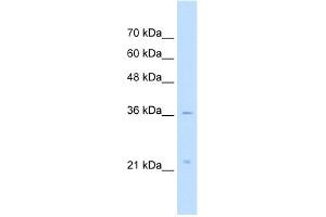 WB Suggested Anti-LAPTM4A Antibody Titration:  5. (LAPTM4A antibody  (Middle Region))