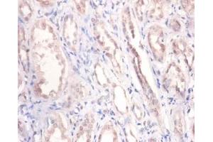 Immunohistochemistry of paraffin-embedded human kidney using PODXL / Podocalyxin antibody at dilution of 1:100. (PODXL antibody  (Biotin))