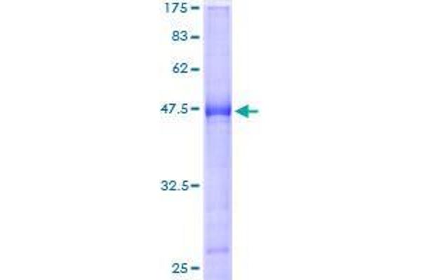 BTG4 Protein (AA 1-206) (GST tag)