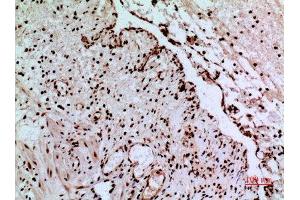 Immunohistochemistry (IHC) image for anti-Calcyclin Binding Protein (CACYBP) (C-Term) antibody (ABIN3187896)