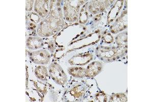 Immunohistochemistry of paraffin-embedded mouse kidney using ESE1/ELF3 Rabbit pAb (ABIN6130347, ABIN6140125, ABIN6140127 and ABIN6221990) at dilution of 1:150 (40x lens).