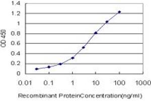 Detection limit for recombinant GST tagged TLR5 is approximately 0. (TLR5 antibody  (AA 517-634))