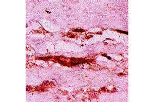 Immunohistochemical detection of MG adducts in atherosclerotic aorta. (Methylglyoxal (MG) antibody)