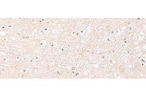 Immunohistochemistry of paraffin-embedded Human brain tissue using FGFR4 Polyclonal Antibody at dilution of 1:25(x200) (FGFR4 antibody)