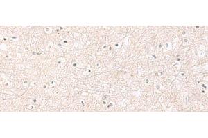 Immunohistochemistry of paraffin-embedded Human brain tissue using FGFR4 Polyclonal Antibody at dilution of 1:25(x200)