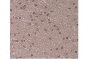 IHC-P analysis of Human Brain Tissue, with DAB staining. (ENPP2 antibody  (AA 637-905))