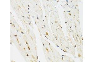 Immunohistochemistry of paraffin-embedded Mouse heart using THAP1 Polyclonal Antibody at dilution of 1:100 (40x lens). (THAP1 antibody)